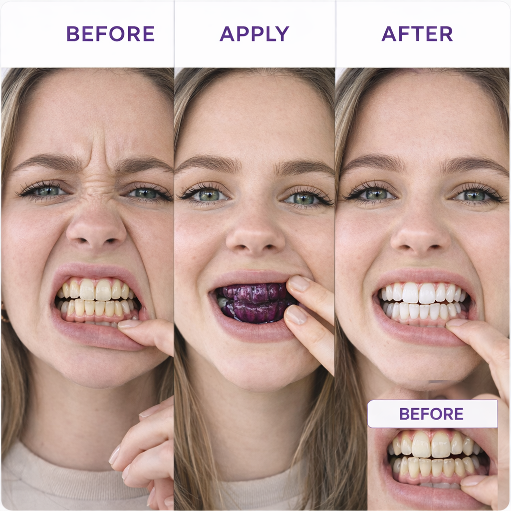 Luma Purple Teeth Whitening Strips My Store
