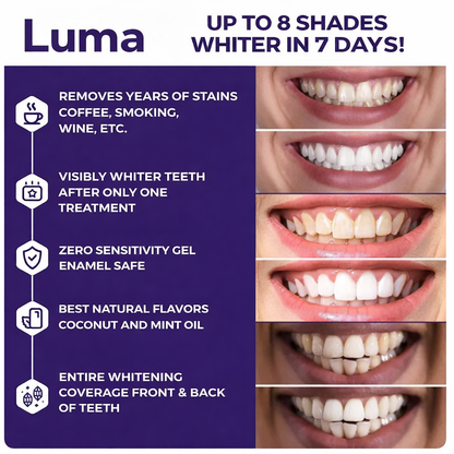Luma Purple Teeth Whitening Strips My Store